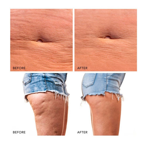 BEAR™ 2 body Dispositivo corporal de microcorrientes Evergreen FOREO Evergreen