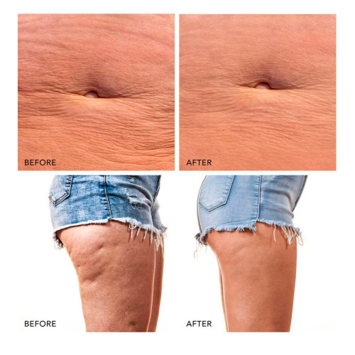 BEAR™ 2 body Dispositivo corporal de microcorrientes Lavender FOREO Lavender