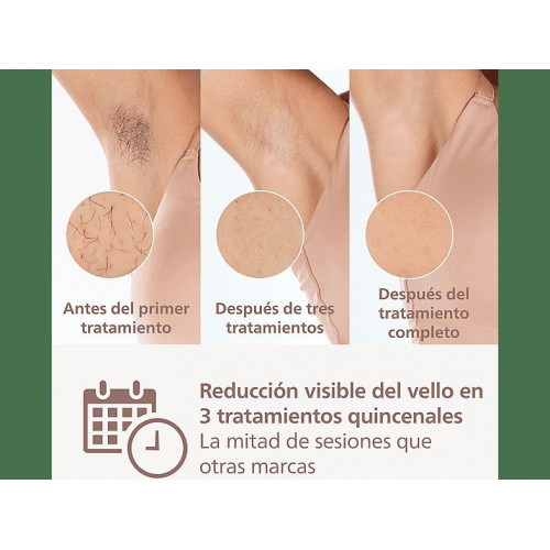 Depiladora IPL - Philips Lumea S8000 BRI945/00, Luz Pulsada en Casa, Con app, Uso con cable, 2 Cabezales, Sensor de Piel Inteligente