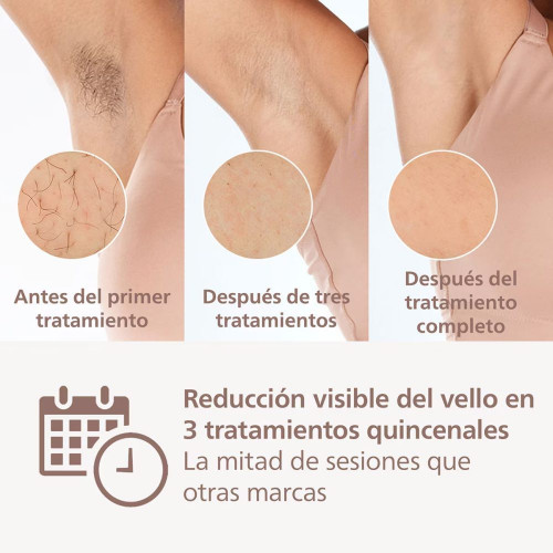 Depiladora IPL Philips Lumea Serie 8000, depilación permanente, luz pulsada, 4 cabezales, cara y cuerpo, sensor de piel inteligente Blanco