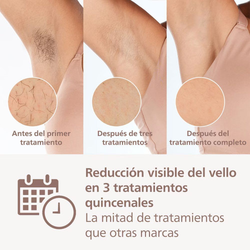 Depiladora IPL Philips Lumea Serie 9000, depilación permanente, uso sin cable, luz pulsada, 3 cabezales, cara y cuerpo, sensor de piel inteligente Blanco