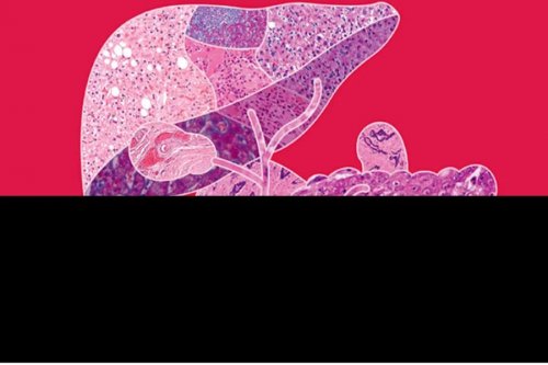 Diagnostic Pathology : Hepatobiliary and Pancreas