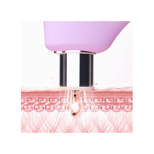 KIWI™ derma - Microdermoabrasión con diamantes Adamas y dispositivo de aspiración de poros FOREO Derma