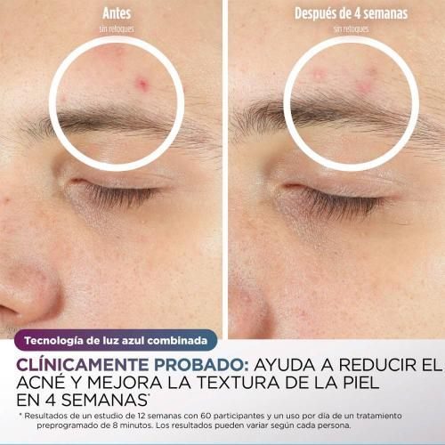Máscara facial Shark FW312EUPL antiedad y de limpieza de cutis