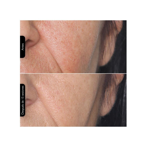 Máscara Facil FaceTite MultiPlatform Silk'n