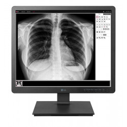 Monitor LG 19HK312C-B 48,3 cm SXGA Negro