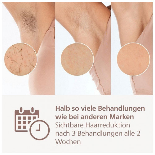 Philips Lumea Series 9900 SkinAI BRI951/00