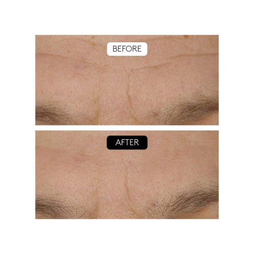 Sérum Antiarrugas Clinical Beauty Filler Cocunat