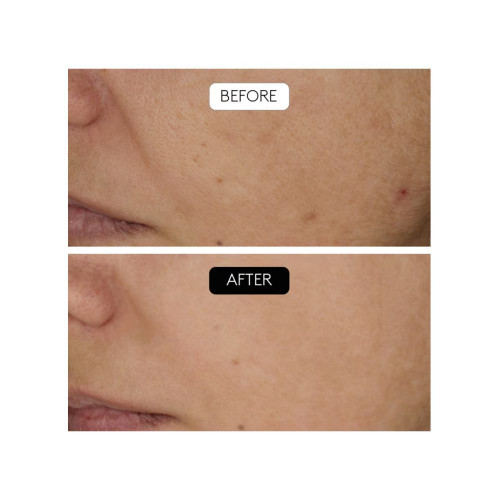 Sérum Antiarrugas Clinical Beauty Filler Cocunat