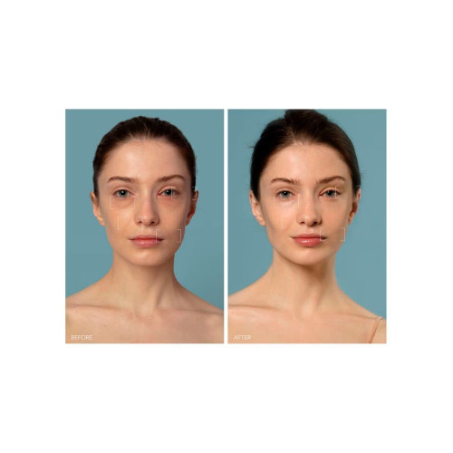 UFO™ 3 - Dispositivo de hidratación facial profunda 5 en 1 FOREO Black