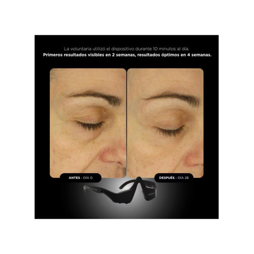 Unictech Eye Mask 5.0 Dispositivo Multifunción Con Tecnología LedNirEms