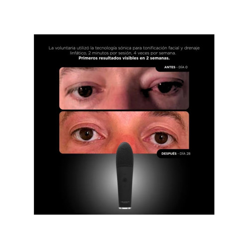 Unicthermo-Sonic 2.0 Dispositivo Facial 3-En-1